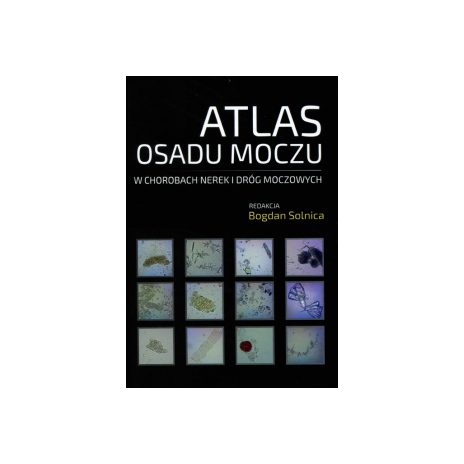 Atlas Osadu Moczu w chorobach nerek i dróg moczowych