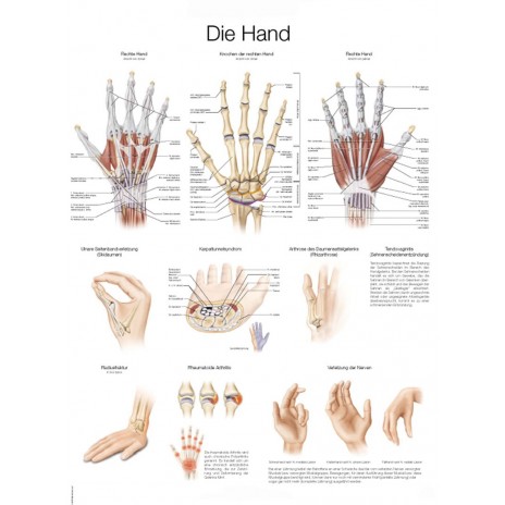 Dłoń - tablica anatomiczna