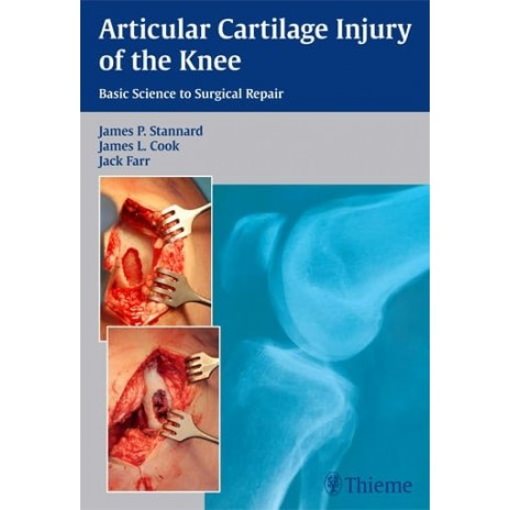 Articular Cartilage Injury of the Knee Basic Science to Surgical Repair